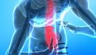 physical therapy for back pain