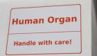 liver transplant experience hepatitis C