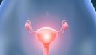 Endometriosis can I have children