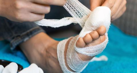 Losing my toenails