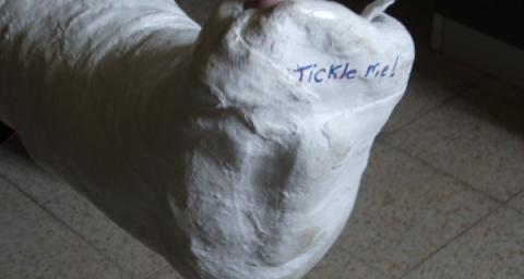 ankle cast fracture