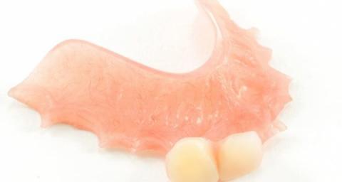 Trauma: How This Smile Was Born