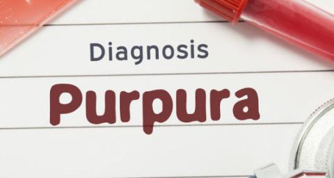 ITP Idiopathic thrombocytopenic purpura personal story