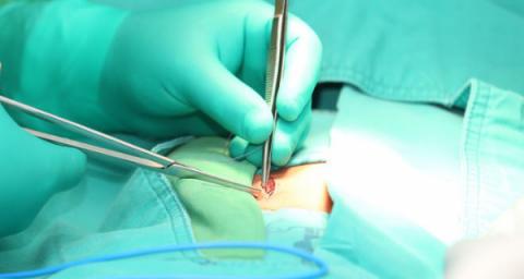 hernia mesh complications personal story