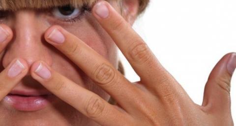 Rosacea personal story