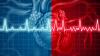 afib cardioversion experience