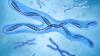 Adoption: 13q Deletion Syndrome