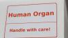 liver transplant experience hepatitis C