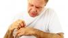 Living with Severe Psoriasis