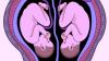 How could I ever choose to save one daughter’s life over the other? 